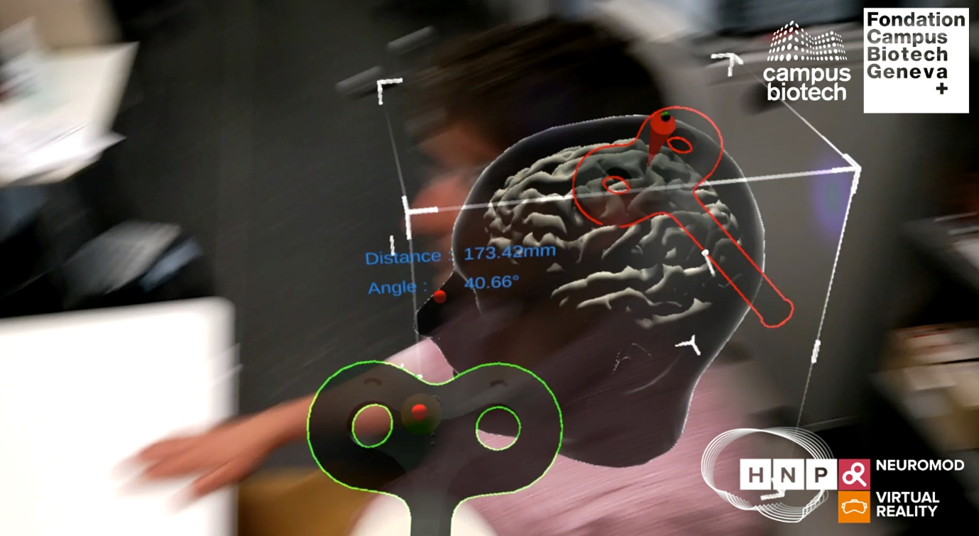 Figure 3. Non-invasive Brain Stimulation combined with Augmented Reality